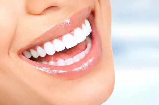 Hollywood Smile