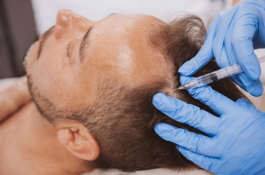 PRP Injections